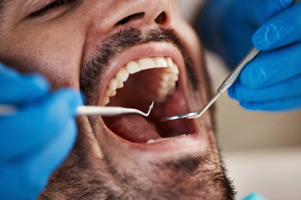 Best Full Mouth Reconstruction  in Clayton, IN